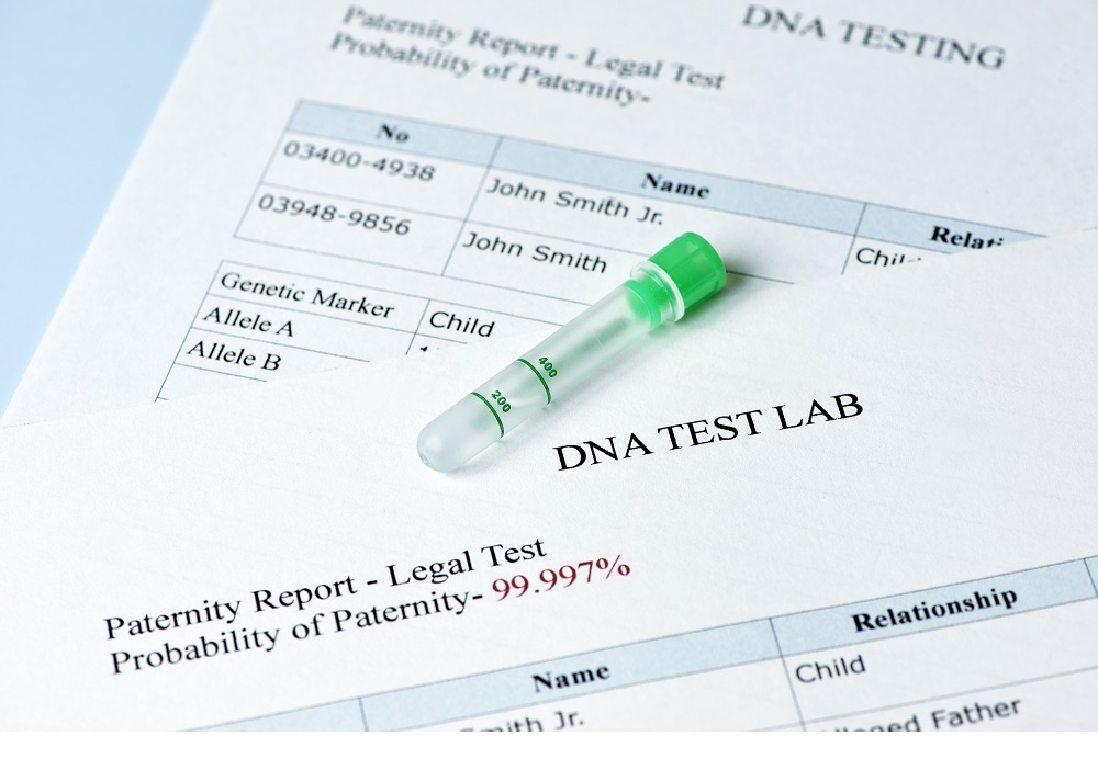 What To Expect From Collection To Results With Home Paternity Testing?